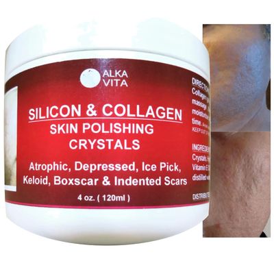 Acne Scars Silicon & Collagen Skin Polishing Crystals Gel For Indented Rolling Atrophic & Keloid Scars Natural Ingredients