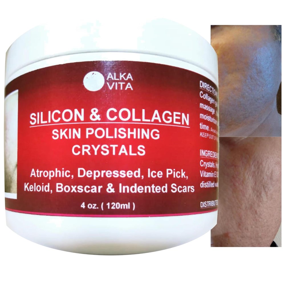 Acne Scars Silicon & Collagen Skin Polishing Crystals Gel For Indented Rolling Atrophic & Keloid Scars Natural Ingredients