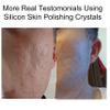 Acne Scars Silicon & Collagen Skin Polishing Crystals Gel For Indented Rolling Atrophic & Keloid Scars Natural Ingredients view 3