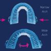 SmartGuard Anti Snore Device. New Customizable Snore Reducing Mouthpiece  Reduce Snoring Aid for Men and Women  Most Comfortable and Adjustable Oral Appliance - Holds Jaw Forward to Open Airway view 2