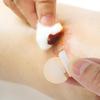 200Pc Round Mini Bandages Flexible Fabric Adhesive Wound Care Stickers Small Hypoallergenic Care Patch for First Aid Protection 0.86In view 2