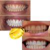 Sowsmile 24K Gold Professional Dental Dentist Bright White Tooth Whitening Bleaching System Gel Remove Yellow Stain Tools view 2