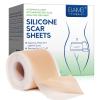 Silicone Scar Sheets (1.6x 130, 3.3M), Professional Silicone Scar Tape, Silicone Scar Strips, Reusable Scar Removal Sheets for Surgical Scars, C-Section, Surgery, Burn, Keloid, Acne view 1