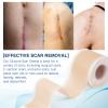 Silicone Scar Sheets (1.6x 130, 3.3M), Professional Silicone Scar Tape, Silicone Scar Strips, Reusable Scar Removal Sheets for Surgical Scars, C-Section, Surgery, Burn, Keloid, Acne view 4