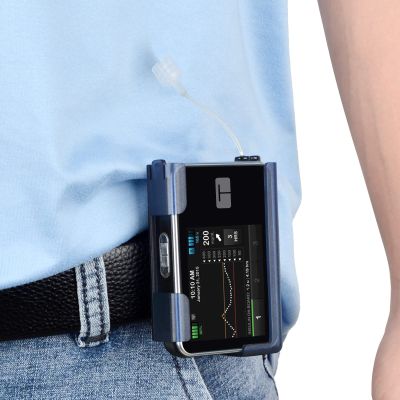 iGuerburn 360 Rotating Case for Tandem tslim X2, Insulin Pump Holder for t Slim/t:Slim G4, t: Holster Belt Clip Not Easy Fall & Break Pump Accessories (Blue)