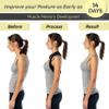 iBYWM Neck Stretcher & Posture Corrector for Women and Men, Cervical Traction for Spine Alignment, Adjustable Upper Back Brace & Elastic Support for Shoulder Back Pain Relief (Black) view 2