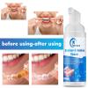 Aligner Cleaner, Denture Cleaner and Whitener Paste Foam Perfect for Sports Mouth Guard and Denture, Fast-Acting Alternative to Retainer Cleaner Tablets, Whitens Teeth and Fights Bad Breath 2 Pack view 4