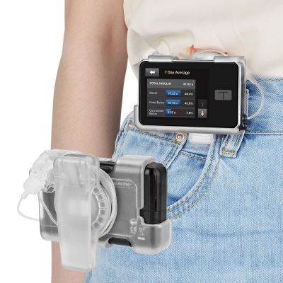iGuerburn (Upgrade) tSlim X2 Pump Case with 360Rotating Clip, Tandem tSlim Pump Holder Spool Up Excess Tubing, t Slim G4 Pump Accessories t:Holster Smooth Edges Won't Peel Off Screen Cover(Clear)