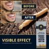 Sewak Al Noor Pack of 10 Miswak Sticks for Teeth with Holder - Vacuum Sealed Natural Flavored Chew Sticks for Humans - Natural Toothbrush for Teeth Whitening, Oral Health & Fresh Breath || Pack of 10 view 4