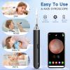 Ear Wax Removal Tool,Prime Earwax Remover with 10 pcs Ear Set for Adults and Kids,Earwax Removal kit with 1080P Waterproof Camera for iPhone,iPad,Android Phones (Black) view 4