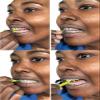 Braces Ortho Floss| 300 Count Bag| 50 Count Bag (Pack of 6) Bonus 6 Interdental Brush| view 2