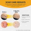 DermAvance Pure Scar Care "Medical Grade Silicone Gel" for Surgical and Facial Marks - Silicone Cream for Effective Scar Management - 1.05822 fl oz (30g), Clear view 3