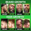 Best Beard Stuff Beard Growth Vitamins - Biotin Gummies for Beard & Hair Growth  Maximum Strength 620,000mcg Biotin with Collagen, MSM, Keratin & Bamboo Extract view 2