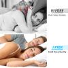 Anti Snoring Devices, Silicone Magnetic Anti Snoring Nose Clip, 6PCS Snore Stopper, Effective to Stop Snoring, Quieter Restful Sleep (White) view 2