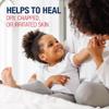 Aquaphor Children's Advanced Therapy Healing Ointment, 41% Petrolatum Skin Protectant Ointment for Minor Wound Care, Chapped or Cracked Skin and Lips, 5 Oz Tube view 3