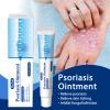 YYDDS Kolmax Psoriasis Soothing Ointment, New Version Natural Chinese Herbal Soothing Ointment, Safe and Effective (2 PCS) view 2