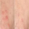 Nakery Intensive Repair Treatment Eczema Relief Soothing Wash for Face & Body | 2% Colloidal Oatmeal | Immediate Relief view 3