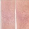 Nakery Intensive Repair Treatment Eczema Relief Soothing Cream for Face & Body | 2% Colloidal Oatmeal | Immediate Relief view 4