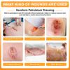 Carbou Medical Xeroform Petrolatum Dressing 5"x9", 25 Individual Pack, Non-Adherent Gauze Pads, Soft Fine Mesh Gauze Patch for Wound Care, Burns, Lacerations, Skin Grafts & Surgical Incisions view 2