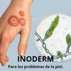 Inoderm, PIMPLES, Eczema, Ringworm, Acne, OINTMEN (1 oz.) view 2