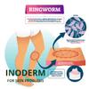 Inoderm, PIMPLES, Eczema, Ringworm, Acne, OINTMEN (1 oz.) view 4