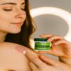 Inoderm, PIMPLES, Eczema, Ringworm, Acne, OINTMEN (2.5 oz.) view 2