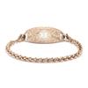 2Pcs Rose Gold Medical Alert ID Tag for Medical Alert Bracelet | Curved Comfort Design - Free Customize Engraved Medical Tag Set view 3