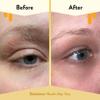 ECZEMA HONEY Multi Peptide Eye Cream - Anti Aging Eye Cream for Dark Circles & Puffiness - Facial Skin Care Products for Eczema, Dry & Sensitive Skin (0.5 Oz) view 4