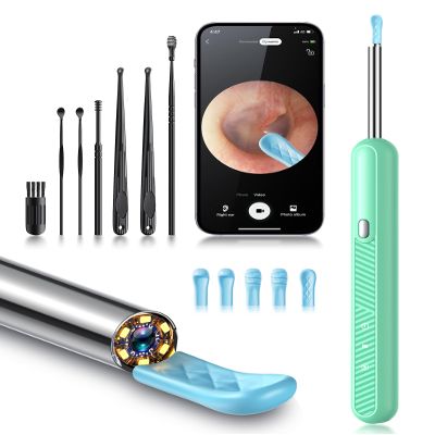 Loyker Ear Wax Removal Tool Camera, Ear Cleaner with 1080P Camera, Earwax Removal Cleaning Kit with 6 Ear Pick, Otoscope for iPhone, iPad, Android Phones, Green