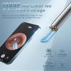 Loyker Ear Wax Removal Tool Camera, Ear Cleaner with 1080P Camera, Earwax Removal Cleaning Kit with 6 Ear Pick, Otoscope for iPhone, iPad, Android Phones, Green view 3