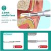 GIENEX Ear Wax Removal, Earwax Remover Tool, Otoscope Endoscope with LED Lights & Camera, Ear Cleaner Ear Pick Ear Cleaning Kit for Kids, Adults & Pets view 3