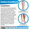 ABSOLUTE SUPPORT Thigh High Compression Socks Women and Men, 20-30mmHg, A203SW view 2