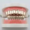 Braces Upper 8 Lower 8 Men and Women 18k Gold-Plated Upper Teeth Lower Teeth, Gold dentures, Gold Eight-Tooth Lower Teeth (Real Gold Plating) view 4