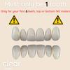 ClearRetain Single Tooth Temporary Tooth Replacement Custom Fit, Realistic Look & Color | Removable Retainer, Professional Lab Grade Quality, Upper Teeth (LOWER ONLY) view 2