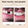 ClearRetain Single Tooth Temporary Tooth Replacement Custom Fit, Realistic Look & Color | Removable Retainer, Professional Lab Grade Quality, Upper Teeth (LOWER ONLY) view 3