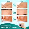 Silicone Scar Sheets, Silicone Scar Tape (1.6"x 60" Roll-1.5M), Reusable and Effective Scar Removal Sheets, Silicone Scar Removal Sheets for Surgical Scars, Healing Keloid, C-Section, Tummy Tuck view 2