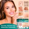 Silicone Scar Sheets, Silicone Scar Tape (1.6"x 60" Roll-1.5M), Reusable and Effective Scar Removal Sheets, Silicone Scar Removal Sheets for Surgical Scars, Healing Keloid, C-Section, Tummy Tuck view 4