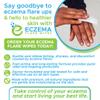 Eczema Flare Wipes - All-Natural Fast Acting Eczema Relief, Anti-Itch, Reduces Inflammation & Protects Skin Barrier, Soothes & Prevents Future Flares, pH-Balancing, Convenient On-The-Go Solution 72ct view 2