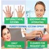 PUREFY Dermal Eczema Spray (4oz, 2pk) Natural Healing. Purefypro Dermal Cleansing Technology. Safe for Kids and Everyone. Use Anywhere on The Body. Dermatologist Recommended.  view 4