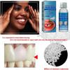 Provisional Tooth Repair Kit, Provisional Fake Teeth Replacement Kit for Provisional Restoration of Missing & Broken Teeth Replacement Dentures, DIY Heat Fit Beads. 30Ml -2 Bottle view 2