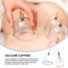 FOMIYES 2Pcs Negative Pressure Massage Cups for Cupping Therapy Body Massage Tool for Improved Circulation Simple and Practical Design for Home Use view 2