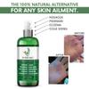Thyme Out All Natural Eczema Treatment- Psoriasis Treatment - an All-in-One Solution for Acne, Dermatitis, Rosacea, Cold Sores, Bites, Poison Ivy - Anti-Itch Spray for Itchy Skin Relief 4oz view 2
