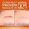 Abera Scar Cream - Advanced Nano Formula for New and Old Scars - Effective for Keloids, Stretch Marks, Surgical Scars, and Acne Marks - Fades Dark Spots & Restores Smooth Skin (1 Box) view 3