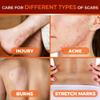 Abera Scar Cream - Advanced Nano Formula for New and Old Scars - Effective for Keloids, Stretch Marks, Surgical Scars, and Acne Marks - Fades Dark Spots & Restores Smooth Skin (1 Box) view 4