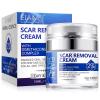 Scar Cream, Scar Removal Cream - Advanced Scar Cream for Surgical Scars, Acne Scars, C-Section, Burns, Stretch Marks -Effective for Old and New Scars Gel Acne Scar Treatment view 1