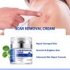 Scar Cream, Scar Removal Cream - Advanced Scar Cream for Surgical Scars, Acne Scars, C-Section, Burns, Stretch Marks -Effective for Old and New Scars Gel Acne Scar Treatment view 2