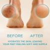 Lee Beauty 8oz Professional Gel Callus Remover for Feet - Original Fast-Acting Formula, Extra Strength for Cracked Heels & Dead Skin (Pack of 2) view 2