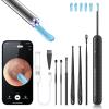 AIFINI Ear Wax Removal, Ear Cleaner with Camera and Light, FSA - HSA Eligible, Ear Wax Removal Tool Camera with 1080P, Ear Cleaning Kit with 6 Spoons, Otoscope for iOS & Android (Black) view 1