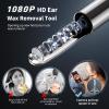 AIFINI Ear Wax Removal, Ear Cleaner with Camera and Light, FSA - HSA Eligible, Ear Wax Removal Tool Camera with 1080P, Ear Cleaning Kit with 6 Spoons, Otoscope for iOS & Android (Black) view 2