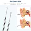 Ear Cleaning Kit,Safe Ear Wax Removal Tool,Earwax Removal Kit,Easy to Use,Painless Ear Pick,with Storage Box and Cleaning Brush (Silver) view 3